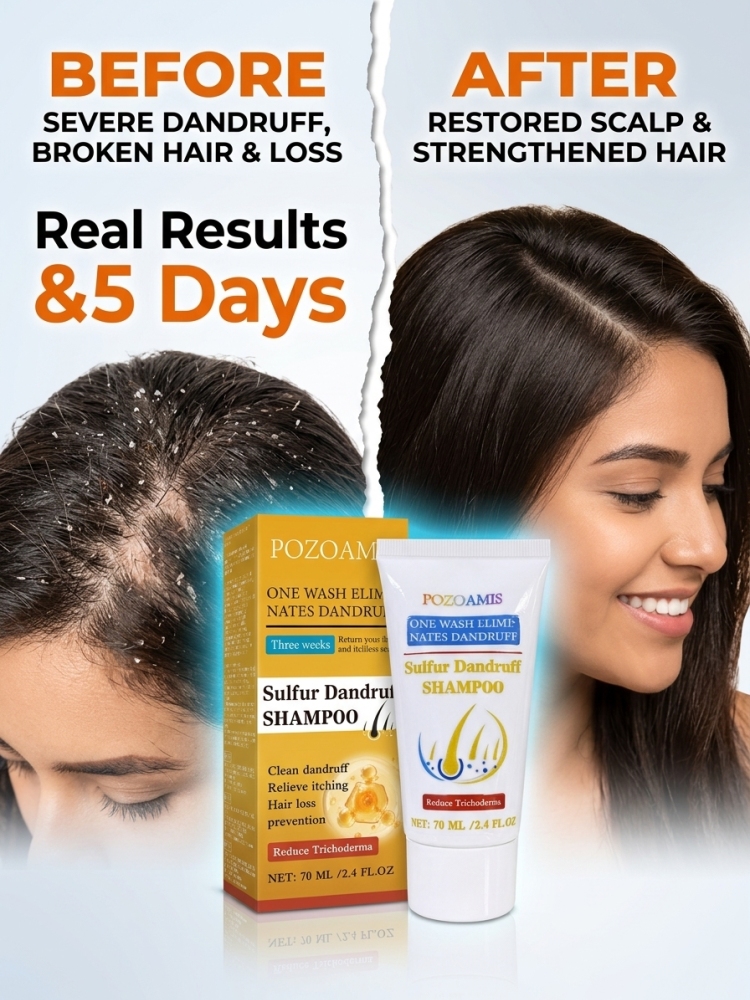 Herbal Anti-Dandruff Shampoo,  - Hair Care Dandruff recension och pris